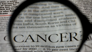 image representation