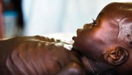 (FILES) This file photo taken on October 11, 2016 shows Agop Manut (11 months), who suffers acute malnutrition and respiratory distress, assisting at the clinic run by Doctors without Borders (MSF) in Aweil, Northern Bahr al Ghazal, South Sudan. AFP / ALB