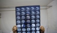 FILE PHOTO: Cancer patient Cao Dongxian poses with CT scan images of his intestine at a hotel room where he stays near the Peking Union hospital in Beijing, China, April 6, 2016 (Reuters / Kim Kyung-Hoon) 