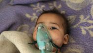 A Syrian child receives treatment at a small hospital in the town of Maaret al-Noman following a suspected toxic gas attack in Khan Sheikhun, a nearby rebel-held town in Syria's northwestern Idlib province, on April 4, 2017. AFP / Mohamed al-Bakour 