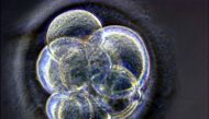REPRESENTATIVE IMAGE: A handout photograph published May 19, 2005, shows a cloned human embryo, created at the Centre for Life in Newcastle upon Tyne, three days after the nuclear transfer took place. Reuters