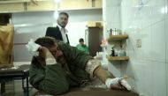 A man lays on a stretcher after receiving treatment, who was injured in an attack carried out by Assad regime forces, which hit a de-escalation zone, at a military hospital in Eastern Ghouta region of Damascus, Syria on October 29, 2017. Ammar Süleyman - 