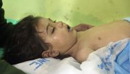 An unconscious Syrian child receives treatment at a hospital in Khan Sheikhun, in the northwestern Syrian Idlib province following a suspected toxic gas attack on April 4, 2017 (AFP Omar haj) 