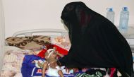 The mother of one-year-old Sameer al-Dhanbari, who suffers from severe malnutrition, helps him as he lies on a bed at a hospital in Houta city, in the southern province of Lahej, Yemen December 5, 2017. Picture taken December 5, 2017. REUTERS/Fawaz Salman