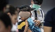 A child injured by firecracker is seen at the Jose Reyes Memorial Medical Center in Manila early on January 1, 2018, after new year's celebrations.  / AFP / NOEL CELIS