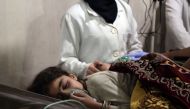 A Syrian girl receives treatment for breathing difficulties at a clinic in Syria's Eastern Ghouta on March 7, 2018, after regime air strikes. AFP / Ammar SULEIMAN