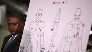 Dr. Bennet Omalu stands by a diagram showing the results of his autopsy of Stephon Clark during a news conference at the Southside Christian Center on March 30, 2018 in Sacramento, California. Justin Sullivan/Getty Images/AFP