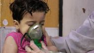 An affected Syrian kid receives medical treatment after Assad regime forces allegedly conducted poisonous gas attack to Duma town of Eastern Ghouta in Damascus, Syria on April 08, 2018.  Mouneb Taim - Anadolu
