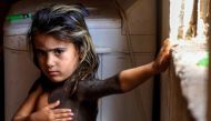 Haura, a four-year-old Iraqi child with a rare skin congenital disease that covers much of her upper body in black marks and hair, looks on as she stands in her family home in the village of Wahed Haziran, Diwaniya province, on April 17, 2018. AFP / Haida