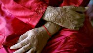 Representative image of an acid attack victim (Reuters / Damir Sagolj) 