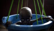 A malnourished girl cries during the daily checkweighing at the Bangui pediatric complex on December 4, 2018. / AFP / FLORENT VERGNES 