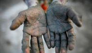 Tota Miya, 10, shows his hands after preparing soil to make bricks in a brick field on the outskirts of Dhaka November 21, 2009. Reuters/Andrew Bira