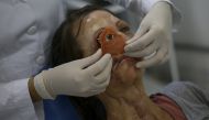  A doctor tests an eye implant on Denise Vicentin, who lost her right eye and part of her jaw to cancer, in Sao Paulo, Brazil, on November 1, 2019. AFP / Miguel Schincariol
 