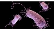 Potentially deadly multidrug-resistant strains of Pseudomonas aeruginosa can infect hospital patients through ventilators and other devices. Reuters/Courtesy of Centers for Disease Control and Prevention (CDC)
 