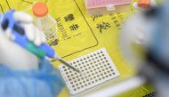 This photo taken on February 6, 2020 shows a laboratory technician working on samples from people to be tested for the new coronavirus at 