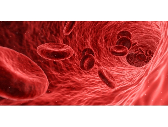 Representational image