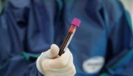 A medical specialist holds a testing tube with blood in Hadassah clinic, which offers tests for for antibodies against the coronavirus disease (COVID-19), at the Skolkovo innovation centre on the outskirts of Moscow, Russia April 24, 2020. REUTERS/Maxim S