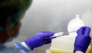 A medical worker analyses swabs in a laboratory of the San Filippo Neri hospital, to check for the coronavirus disease (COVID-19), in Rome, Italy, May 7, 2020. REUTERS/Yara Nardi
