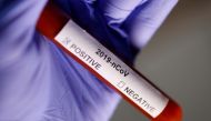 :FILE PHOTO: Test tube with Corona virus name label is seen in this illustration taken on January 29, 2020. REUTERS/Dado Ruvic/File Photo
