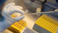 A scientist dilutes samples during the research and development of a vaccine against the coronavirus disease (COVID-19) at a laboratory of BIOCAD biotechnology company in Saint Petersburg, Russia June 11, 2020. REUTERS/Anton Vaganov
