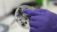 Employee at Science4you factory shows the result of an experiment of the Antivirus Lab science toy, in Lisbon, Portugal, December 2, 2020. Picture taken December 2, 2020. REUTERS/Pedro Nunes