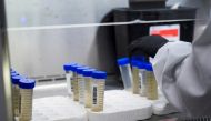 A lab technician tests wastewater samples from around the United States for the coronavirus disease (Covid-19) at the Biobot Analytics, in Cambridge, Massachusetts, US, February 22, 2022. (REUTERS/Allison Dinner)
