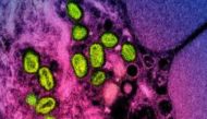 (FILES) This undated file image obtained from the National Institute of Allergy and Infectious Diseases (NIAID) in Bethesda, Maryland, shows a colorized transmission electron micrograph of monkeypox particles (green) found within an infected cell (pink and purple), cultured in the laboratory. (Photo by Handout / National Institute of Allergy and Infectious Diseases / AFP) 

