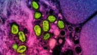 File: This undated file image obtained from the National Institute of Allergy and Infectious Diseases (NIAID) in Bethesda, Maryland, shows a colorised transmission electron micrograph of monkeypox particles (green) found within an infected cell (pink and purple), cultured in the laboratory. (Photo by Handout / National Institute of Allergy and Infectious Diseases / AFP)