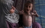 File photo of a Gazan mother carrying her son who is showing signs of malnutrition. AFP.