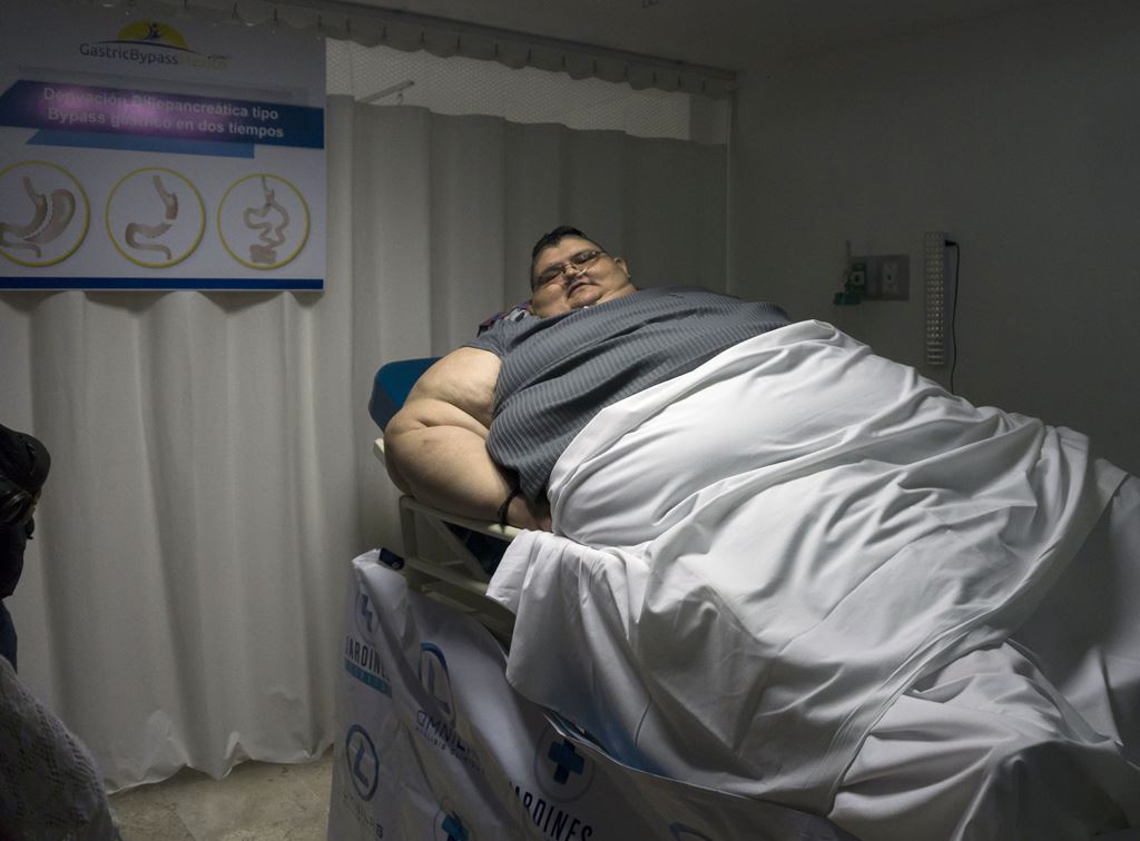 Mexican 32-year-old Juan Pedro Franco, who weighs almost 500 kilograms (1100 pounds) answers questions during a press conference at the hospital in Guadalajara, Mexico on December 21, 2016. AFP / Hector Guerrero

