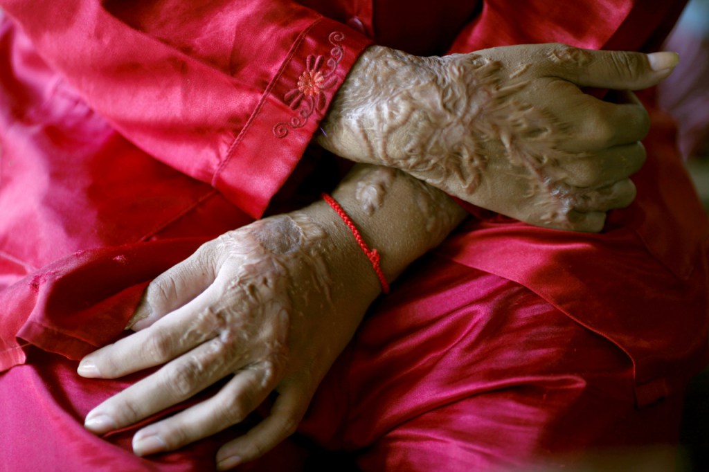 Representative image (Reuters / Damir Sagolj) 