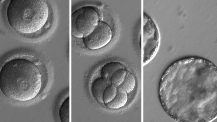This sequence of images shows the development of embryos after being injected with biological kit to edit their DNA, removing a genetic mutation known to cause hypertrophic cardiomyopathy. (Oregon Health & Science University)