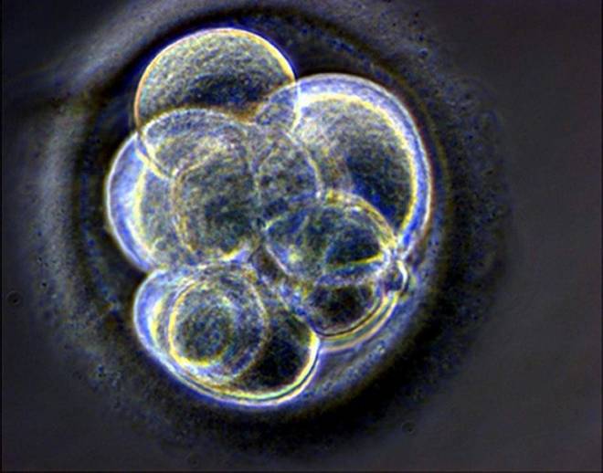 REPRESENTATIVE IMAGE: A handout photograph published May 19, 2005, shows a cloned human embryo, created at the Centre for Life in Newcastle upon Tyne, three days after the nuclear transfer took place. Reuters