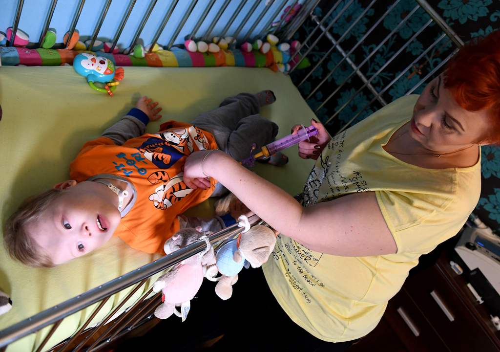 Polish mother Dorota Schewe feeds her five-year-old son Krzysztof via a tube to his stomach on October 30, 2017 in Siedlce, central Poland. AFP / JANEK SKARZYNSKI
