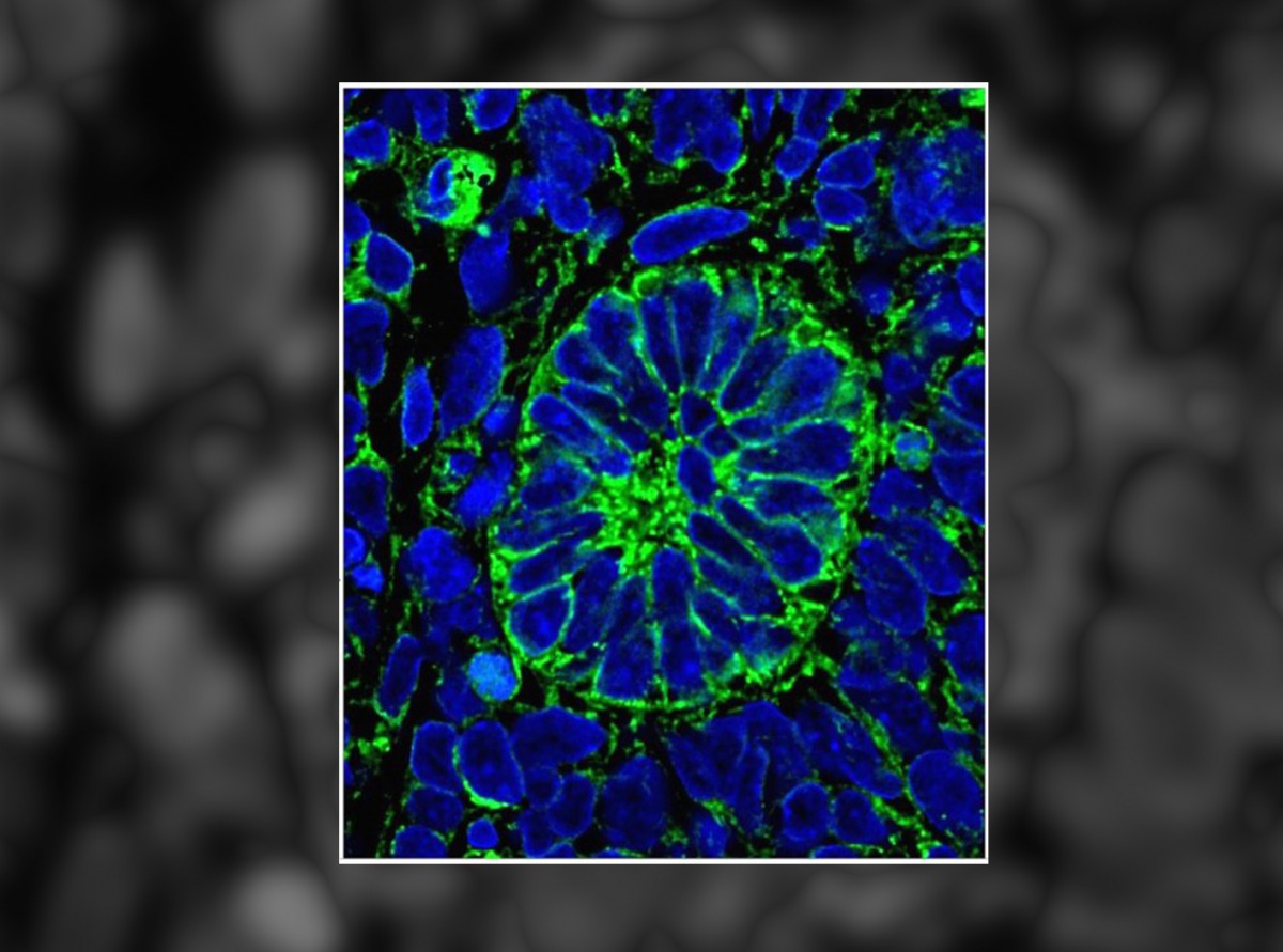 Kidney glomeruli -- constituent microscopic parts of the organ- were generated from human embryonic stem cells grown in plastic laboratory culture dishes. Credit: Image courtesy of University of Manchester