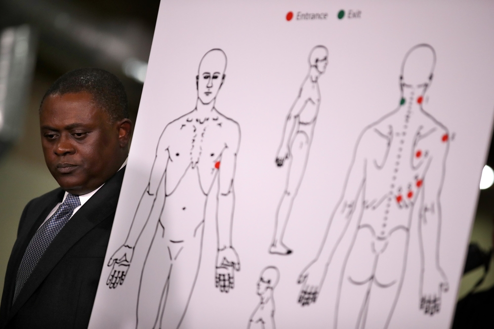 Dr. Bennet Omalu stands by a diagram showing the results of his autopsy of Stephon Clark during a news conference at the Southside Christian Center on March 30, 2018 in Sacramento, California. Justin Sullivan/Getty Images/AFP
