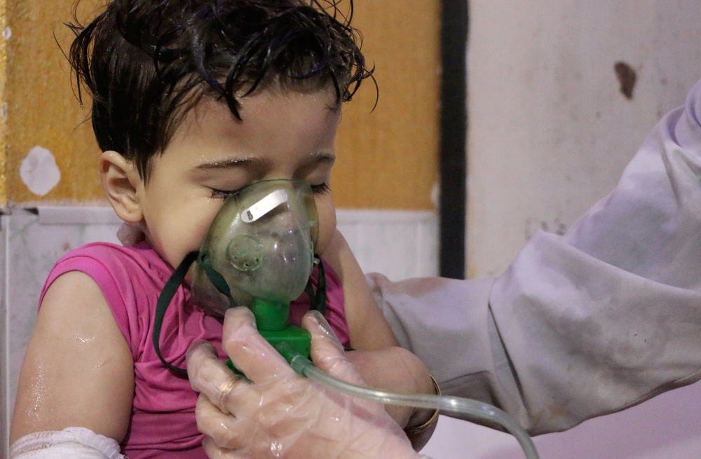 An affected Syrian kid receives medical treatment after Assad regime forces allegedly conducted poisonous gas attack to Duma town of Eastern Ghouta in Damascus, Syria on April 08, 2018.  Mouneb Taim - Anadolu
