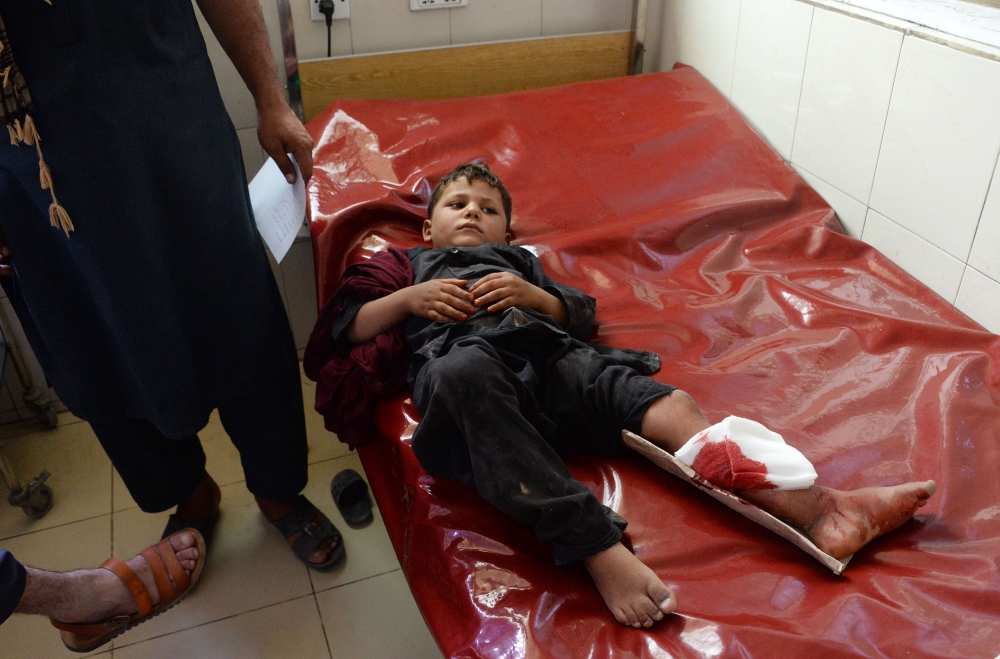 An Afghan wounded boy receives treatment at a hospital following multiple explosions in Jalalabad on September 11, 2018.  / AFP / NOORULLAH SHIRZADA 