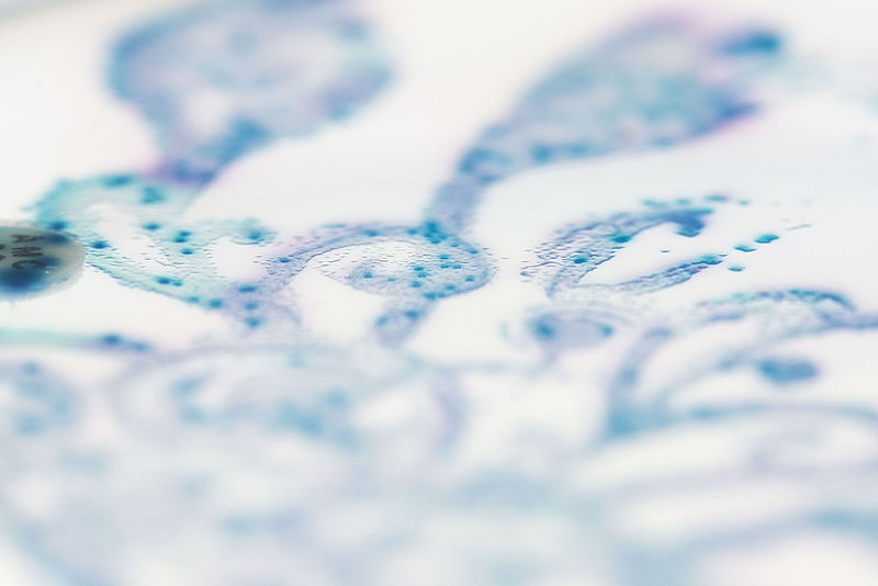 This set of works depicts the ecosystem of gut bacteria which help keep us healthy. Nicola Fawcett/Wikimedia Commons/CC BY-SA 4.0 	