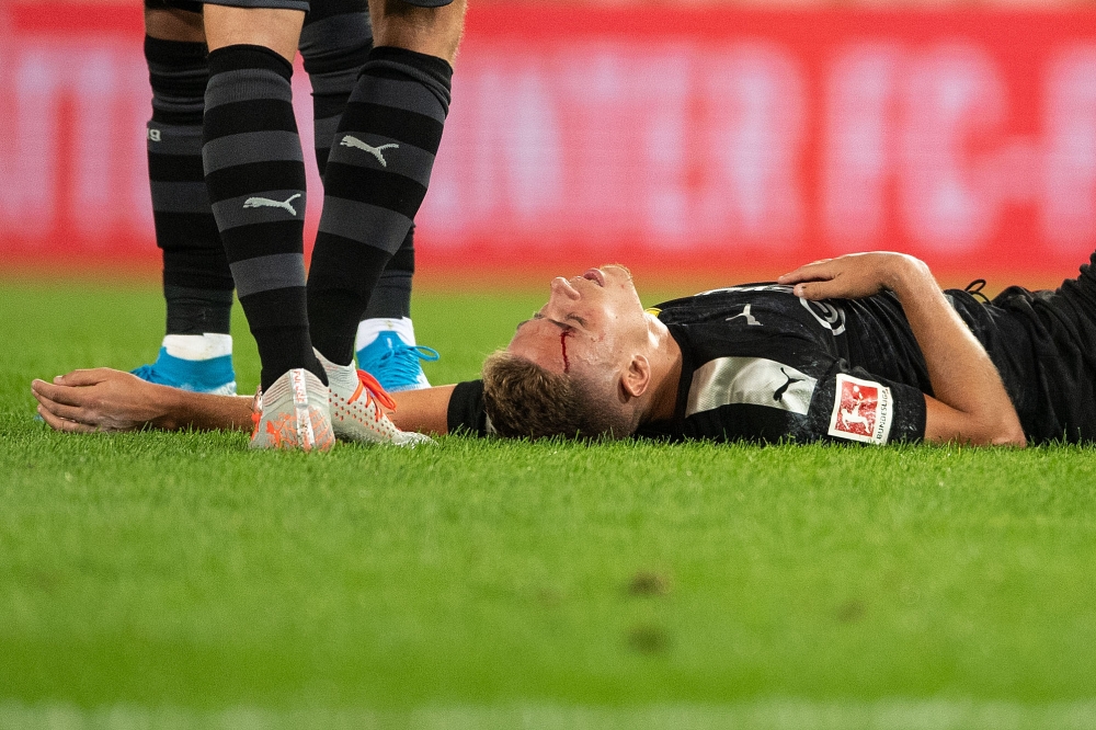 Dortmund's Belgian forward Thorgan Hazard bleeds from he injury sustained during the German first division Bundesliga football match 1 FC Cologne v BVB Borussia Dortmund in Cologne, western Germany on August 23, 2019.  AFP / Marius Becker 