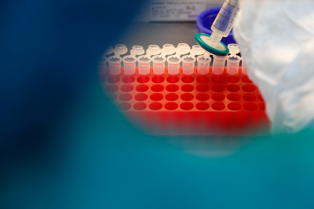 A scientist filters out samples during the research and development of a vaccine against the coronavirus disease (COVID-19) at a laboratory of BIOCAD biotechnology company in Saint Petersburg, Russia June 11, 2020. REUTERS/Anton Vaganov
