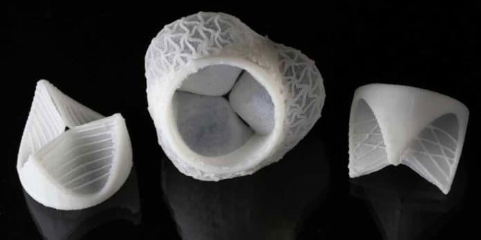 Multi-material additive manufacturing of patient-specific shaped heart valves. Elastomeric printing enables mechanical matching with the host biological tissue. (Photograph: Fergal Coulter / ETH Zurich)
