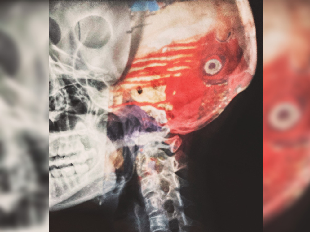 Photo for representational purposes only. Xiao Cui/Unsplash

