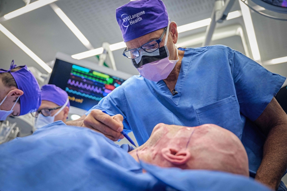In this May 27, 2023, image released by NYU Langone Health, Dr. Eduardo Rodriguez operates on Aaron James in the first whole-eye and partial face transplant, at NYU Langone Health in New York. (Photo by Joe Carrotta / NYU Langone Health / AFP) 
