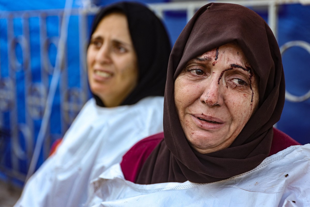 An injured woman reacts after identifying a member of her family among the dead at the al-Maamadani hospital, following an Israeli strike that killed more than 90 people on a school sheltering displaced Palestinians in Gaza City on August 10, 2024. Photo by Omar AL-QATTAA / AFP