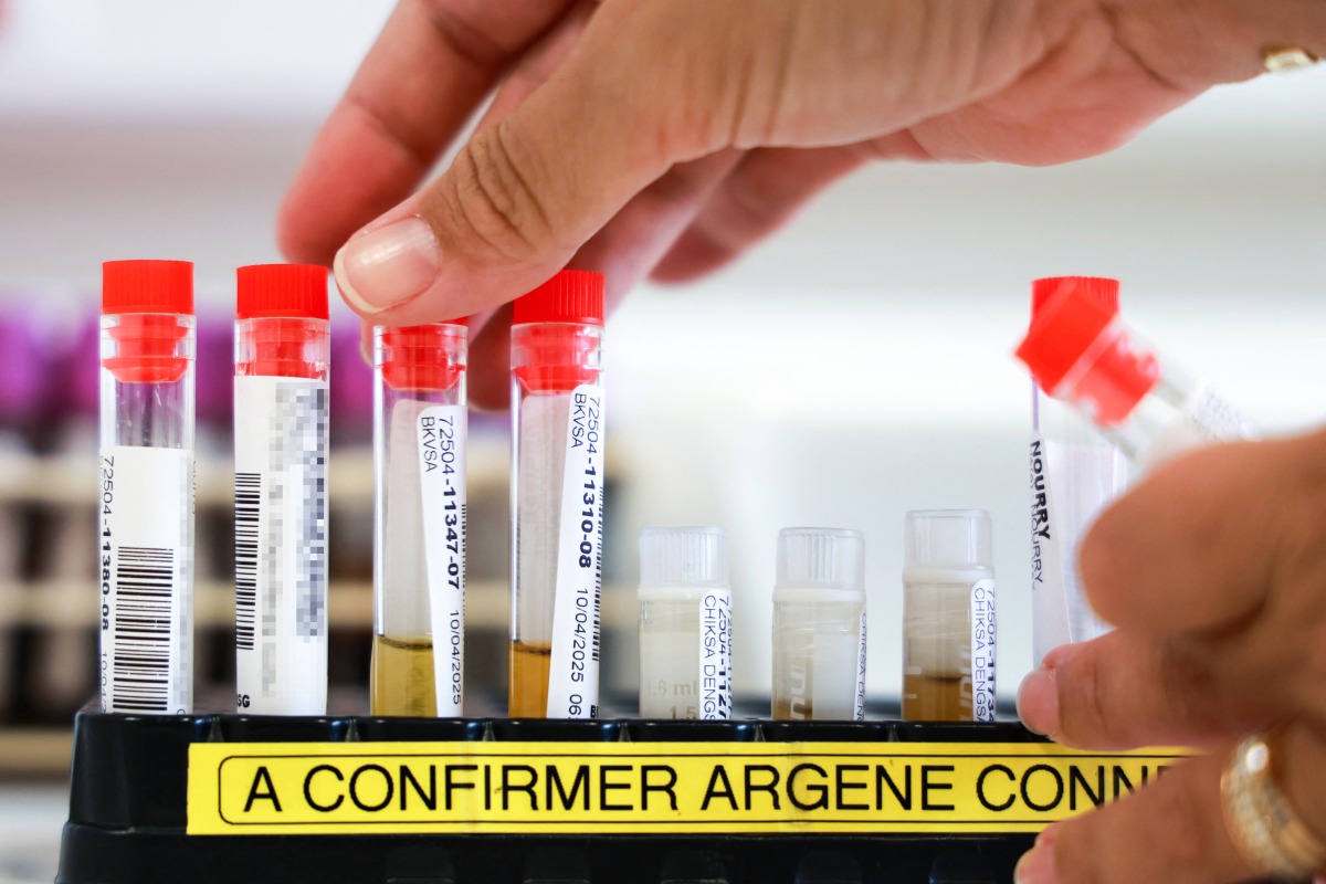 This photograph shows samples for screening test during the chikungunya epidemic at the biology centre of the University Hospital Center in Saint-Denis, France's overseas Indian ocean island of La Reunion, on April 10, 2025. Photo by Richard BOUHET / AFP