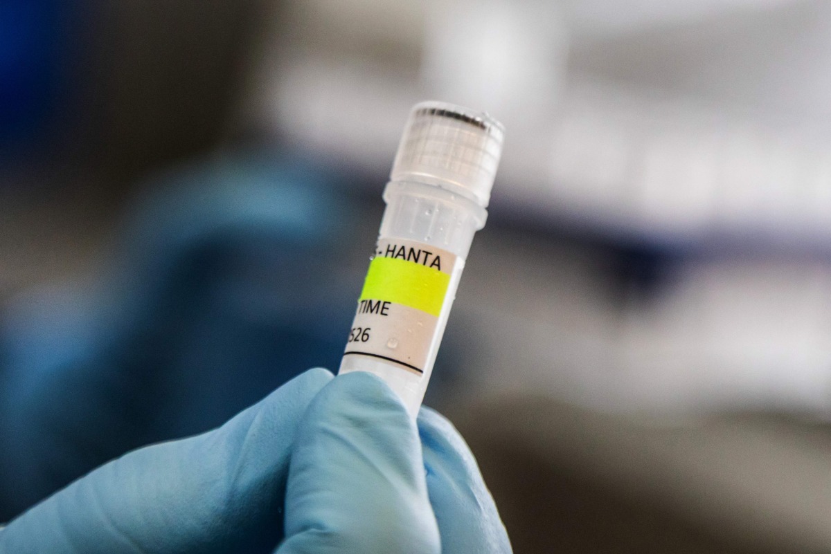 nstitute holding a container used to diagnose the Andes hantavirus, which contains RNA from the Andes virus as part of the detection process, in Buenos Aires on May 6, 2026. Argentina has seen an increase in hantavirus cases but not an outbreak, an expert told AFP on May 6, as infections aboard a cruise ship have provoked a global health scare. The MV Hondius set sail from Ushuaia in southern Argentina on April 1 and is currently anchored off the coast of Cape Verde after three passengers died, possibly of hantavirus. (Photo by Handout / ARGENTINE HEALTH MINISTRY / AFP) 